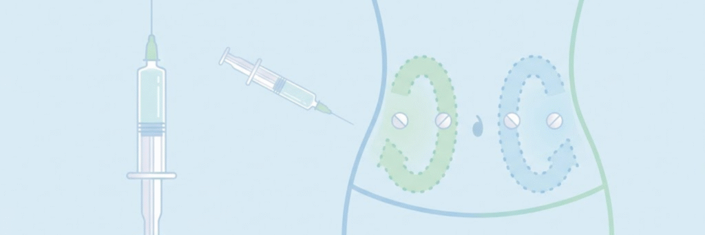 Diagram of belly injection sites for daily enoxaparin during an IVF cycle